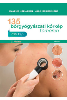 135 bőrgyógyászati kórkép tömören (új kiadás)